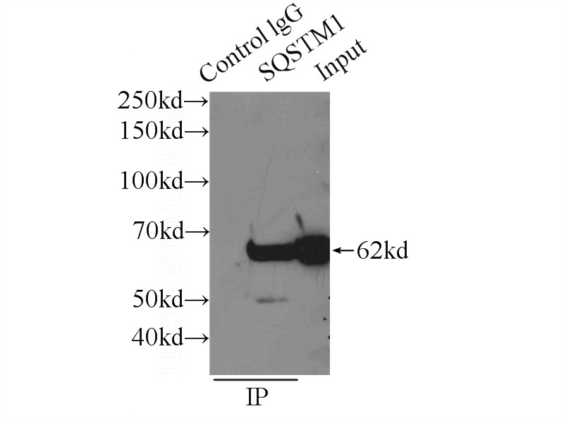 IP Result of anti-P62;SQSTM1 (IP:Catalog No:113557, 3ug; Detection:Catalog No:113557 1:2000) with HEK-293 cells lysate 1300ug.