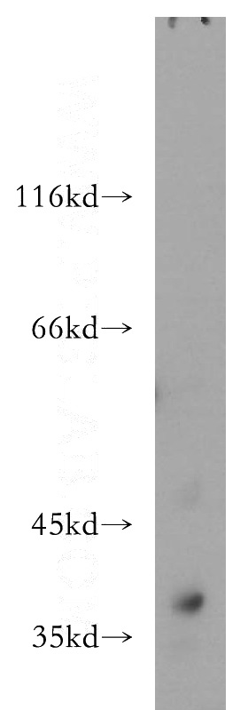 mouse kidney tissue were subjected to SDS PAGE followed by western blot with Catalog No:108267(ASPA antibody) at dilution of 1:100
