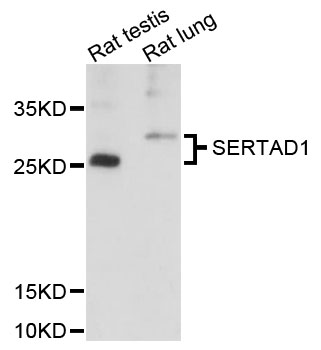 Western blot - SERTAD1 Polyclonal Antibody 