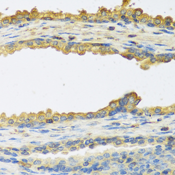 Immunohistochemistry - TSHB Polyclonal Antibody 