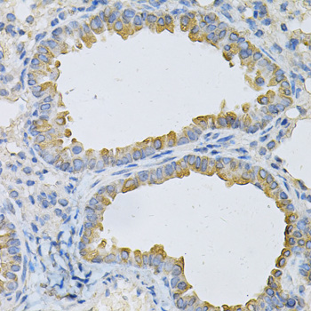 Immunohistochemistry - AP2B1 Polyclonal Antibody 