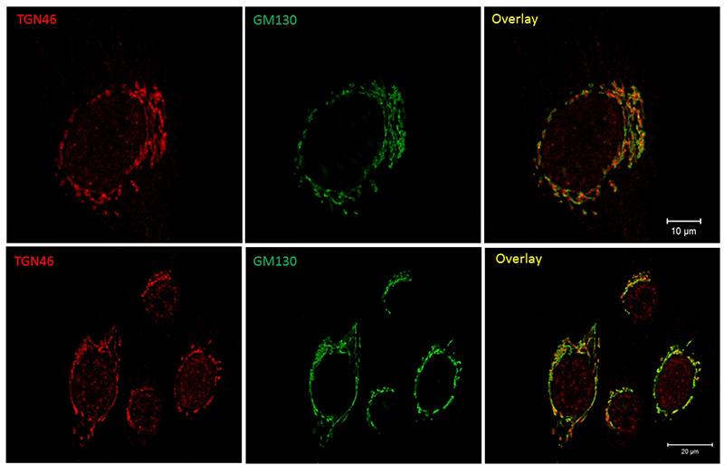 IF result of TGOLN2/TGN46 antibody (1:50) with Human Fibroblast (primary cells) By Dr. Neeraj Tiwar, Rothman Lab, Yale School of Medicine. Fixed with 4% PFA 10 min.