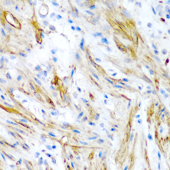 Immunohistochemistry - LMOD1 Polyclonal Antibody 