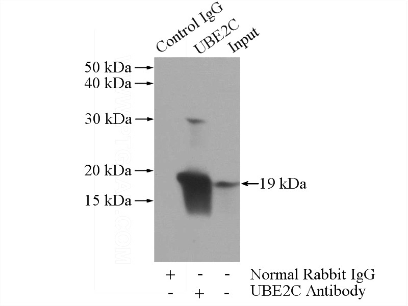 IP Result of anti-UBE2C (IP:Catalog No:116517, 3ug; Detection:Catalog No:116517 1:300) with HeLa cells lysate 2440ug.
