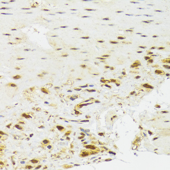 Immunohistochemistry - EFTUD2 Polyclonal Antibody 