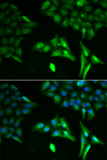 Immunofluorescence - ACADS Polyclonal Antibody 