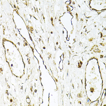 Immunohistochemistry - CD31 Polyclonal Antibody 