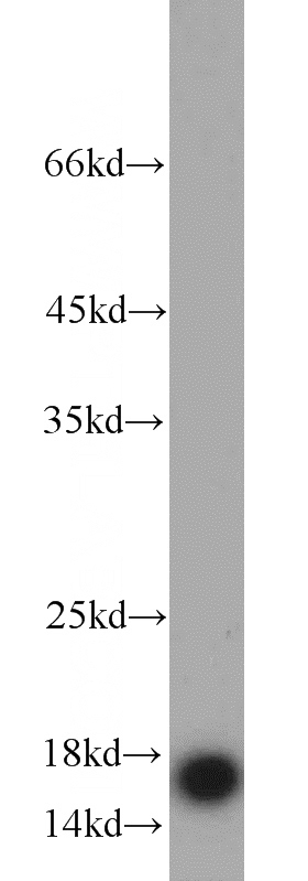 mouse spleen tissue were subjected to SDS PAGE followed by western blot with Catalog No:111583(IBA1 antibody) at dilution of 1:1000