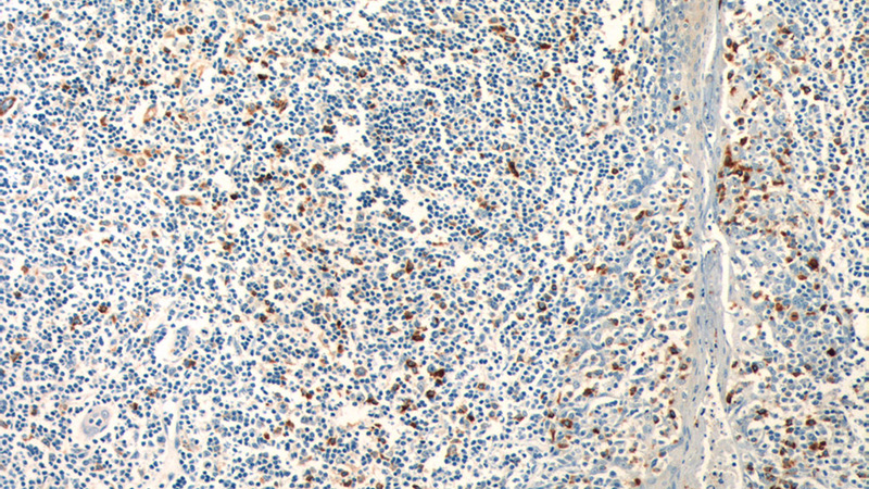 Immunohistochemistry of paraffin-embedded human tonsillitis tissue slide using Catalog No:113483(PADI4 Antibody) at dilution of 1:200 (under 10x lens)