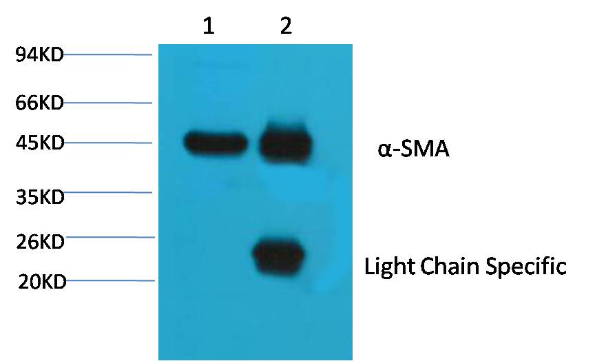 Western blot analysis of 1) Hela, 2) Mouse Brain tissue, 3) Rat Brain tissue with  diluted at 1:20,000.