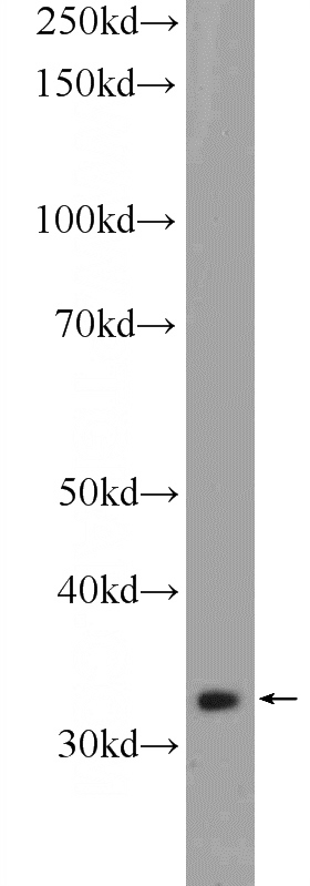 K-562 cells were subjected to SDS PAGE followed by western blot with Catalog No:108707(C21orf59 Antibody) at dilution of 1:1000