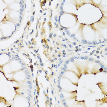 Immunohistochemistry - RNASE3 Polyclonal Antibody 