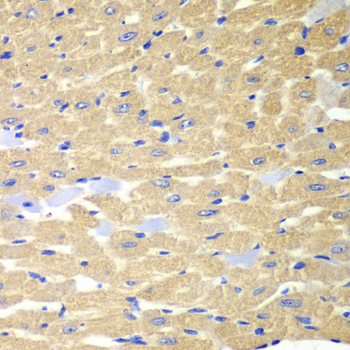 Immunohistochemistry - RPH3A Polyclonal Antibody 