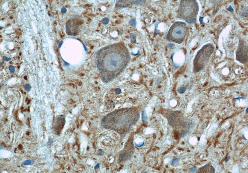 Immunohistochemical of paraffin-embedded rat brain using Catalog No:117307(tubulin-beta antibody) at dilution of 1:50 (under 40x lens)