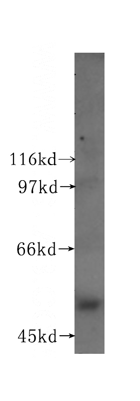 HEK-293 cells were subjected to SDS PAGE followed by western blot with Catalog No:112266(LTF antibody) at dilution of 1:500