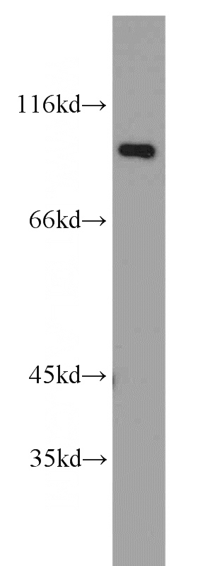 human brain tissue were subjected to SDS PAGE followed by western blot with Catalog No:115740(STT3B antibody) at dilution of 1:2000