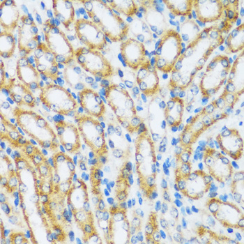Immunohistochemistry - ARHGEF5 Polyclonal Antibody 