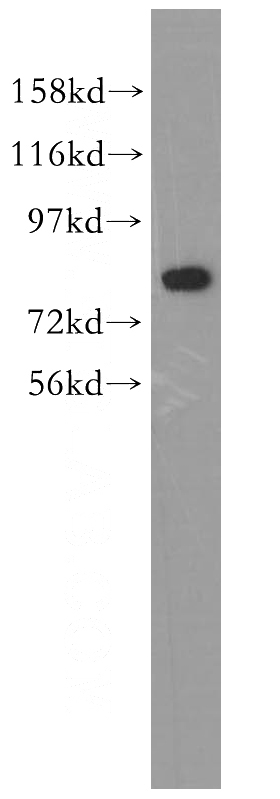 human brain tissue were subjected to SDS PAGE followed by western blot with Catalog No:109628(CUX1 antibody) at dilution of 1:2000