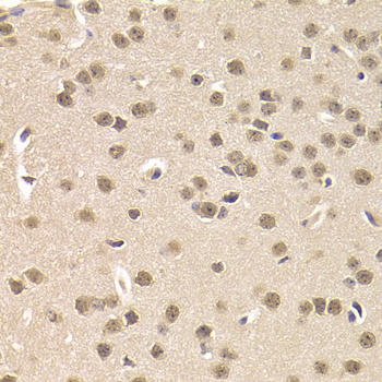 Immunohistochemistry - CSNK1E Polyclonal Antibody 