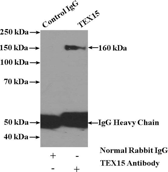 IP Result of anti-TEX15 (IP:Catalog No:115960, 4ug; Detection:Catalog No:115960 1:300) with PC-3 cells lysate 3200ug.