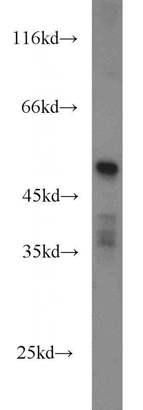 human placenta tissue were subjected to SDS PAGE followed by western blot with Catalog No:111716(HTRA4 antibody) at dilution of 1:500