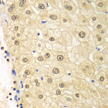 Immunohistochemistry - PSMD2 Polyclonal Antibody 