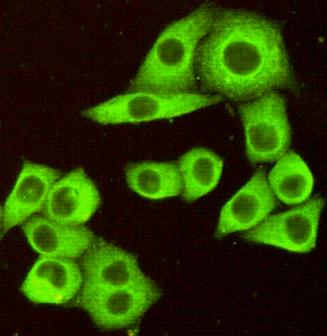 Immunocytochemistry of HeLa cells fixed by Paraformaldehyde and using DR5 mouse mAb diluted 1:100.