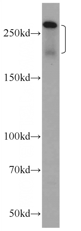 HepG2 cells were subjected to SDS PAGE followed by western blot with Catalog No:112806(ABCC2 Antibody) at dilution of 1:600