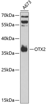 Western blot - OTX2 Polyclonal Antibody 
