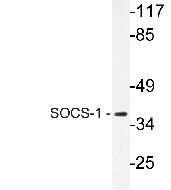 Western Blot analysis of Jurkat cell lysate using SOCS-1 Polyclonal Antibody