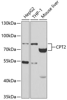 Western blot - CPT2 Polyclonal Antibody 
