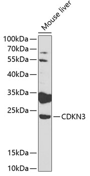 Western blot - CDKN3 Polyclonal Antibody 