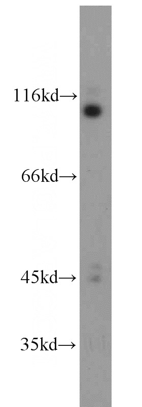 mouse testis tissue were subjected to SDS PAGE followed by western blot with Catalog No:112212(LGR6 antibody) at dilution of 1:100