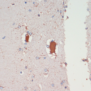 Immunohistochemistry - LRRK2 Polyclonal Antibody 