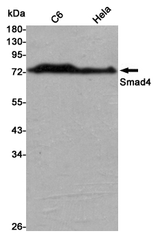 Western blot detection of Smad4 in C6 and Hela cell lysates using Smad4 mouse mAb (1:1000 diluted).Predicted band size:65KDa.Observed band size:70KDa.