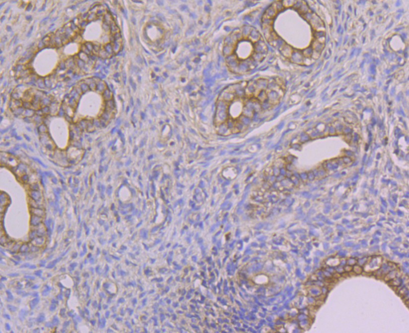 Fig2: Immunohistochemical analysis of paraffin-embedded rat uterus tissue using anti-Alpha-2-macroglobulin antibody. The section was pre-treated using heat mediated antigen retrieval with sodium citrate buffer (pH 6.0) for 20 minutes. The tissues were blocked in 5% BSA for 30 minutes at room temperature, washed with ddH2O and PBS, and then probed with the antibody at 1/50 dilution, for 30 minutes at room temperature and detected using an HRP conjugated compact polymer system. DAB was used as the chrogen. Counter stained with hematoxylin and mounted with DPX.