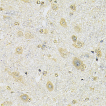 Immunohistochemistry - SLC2A13 Polyclonal Antibody 