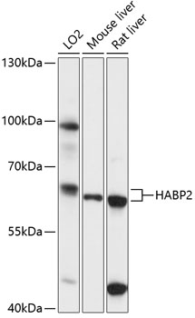 Western blot - HABP2 Polyclonal Antibody 