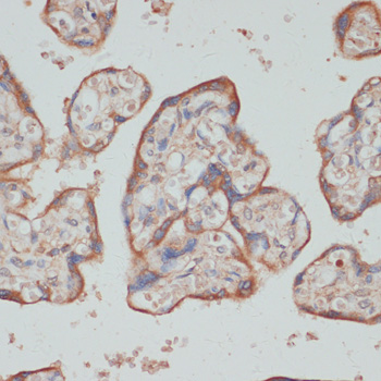Immunohistochemistry - TES Polyclonal Antibody 