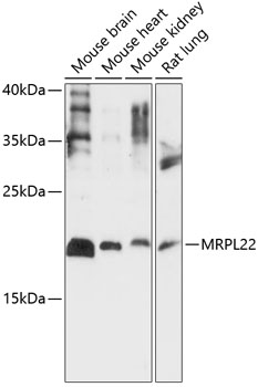 Western blot - MRPL22 Polyclonal Antibody 