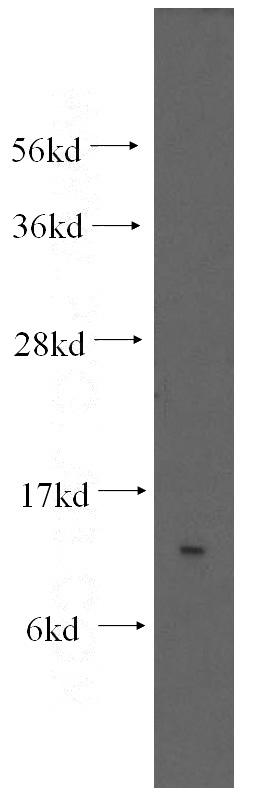 mouse uterus tissue were subjected to SDS PAGE followed by western blot with Catalog No:115136(SF3B14 antibody) at dilution of 1:300