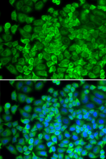 Immunofluorescence - GLA Polyclonal Antibody 