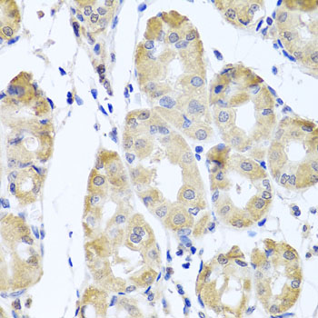 Immunohistochemistry - CBR4 Polyclonal Antibody 