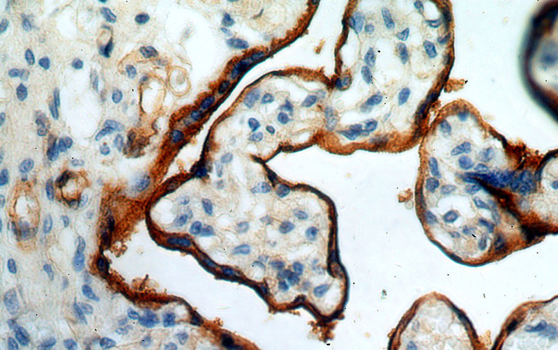 Immunohistochemical of paraffin-embedded human placenta using Catalog No:110330(ENTPD1 antibody) at dilution of 1:50 (under 40x lens)