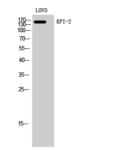Fig1:; Western Blot analysis of LOVO cells using KPI-2 Polyclonal Antibody