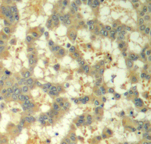 Immunohistochemistry - Phospho-SYK-Y323 pAb 
