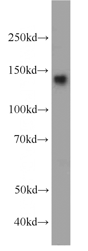HeLa cells were subjected to SDS PAGE followed by western blot with Catalog No:107844(AHI1 antibody) at dilution of 1:1000