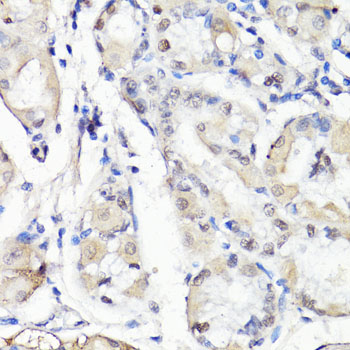 Immunohistochemistry - TBX20 Polyclonal Antibody 