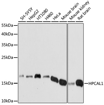 Western blot - HPCAL1 Polyclonal Antibody 