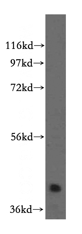 HEK-293 cells were subjected to SDS PAGE followed by western blot with Catalog No:114617(RBM4B antibody) at dilution of 1:500